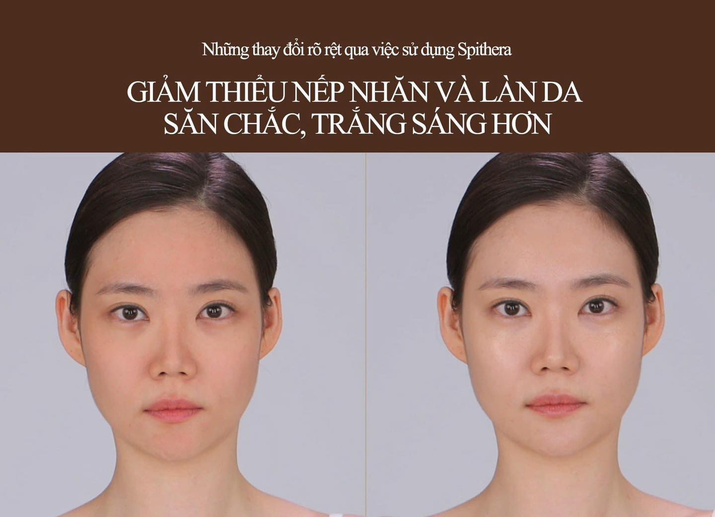 NUDIQUE DIA Spithera Ampoule - Vi Gai Vi Tuần Hoàn